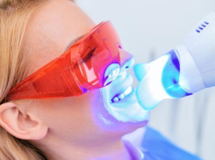 Does Professional Teeth Whitening Really Work?